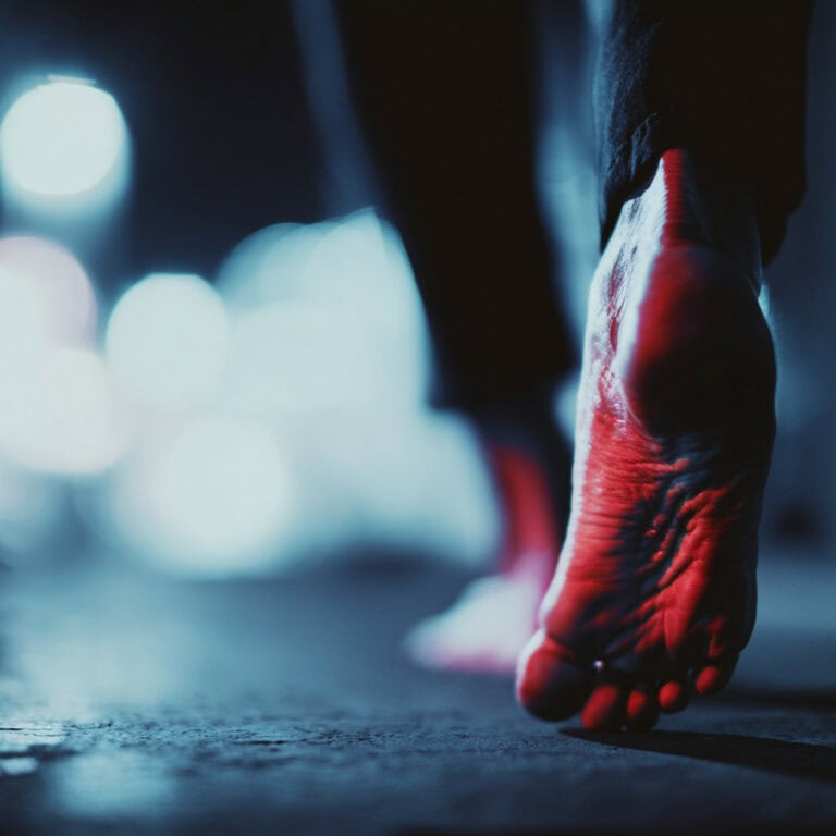 Feet experiencing burning and tingling from peripheral neuropathy nerve damage